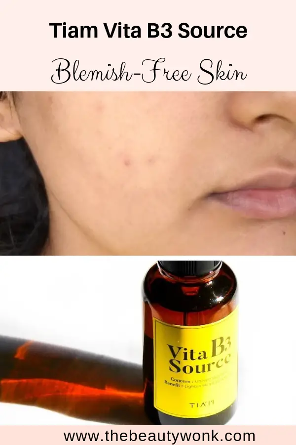 How I removed blemishes with Tiam Vita B3 Source
