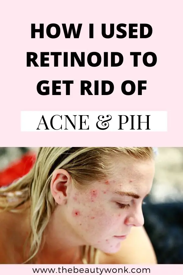 My Retinoid Skincare Routine